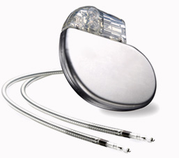 A modern implanted cardiac device (pacemaker/ICD) with leads